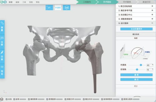 3d打印人體骨骼 這家哈佛大學(xué)孵化的公司要為中國(guó)醫(yī)生開(kāi)發(fā)自己的軟件平臺(tái)...